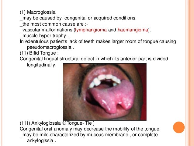 oral facial genetic disorders Oral facial genetic disorders